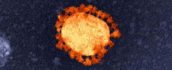An electron microscope image of the corona virus responsible for causing the COVID-19 disease
