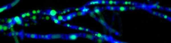 Microscopic abstract image of blue and green lines across a black background