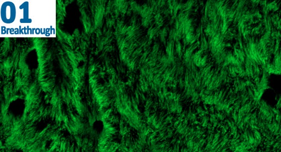 Lab-grown airway cells (cilia) stained green