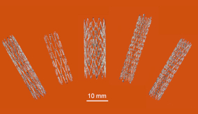 3d-printed nitinol stents in various sizes