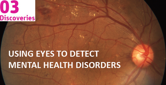 Text: Using eyes to detect mental health disorders over image of eye