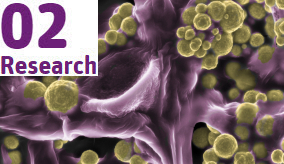 electronmicroscope image of gold on fungi. purple fibres with golden globs