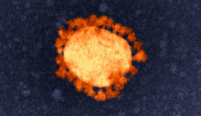 A scientific image of COVID-19